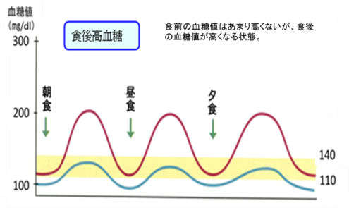 食後の高血糖について